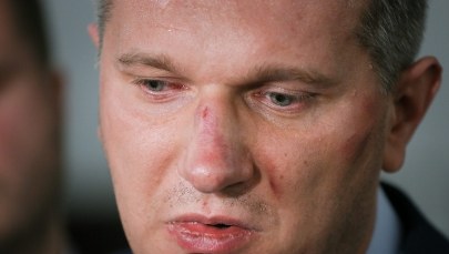 Poseł Wipler nie był pod wpływem narkotyków