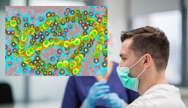 "Potrójna epidemia to nie wszystko". Przybywa zakażeń groźnym paciorkowcem