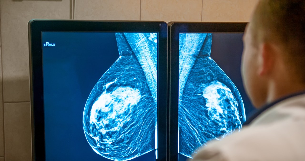 Potrójnie ujemny raka piersi (TNBC) to jeden z najgorszych nowotworów /123RF/PICSEL