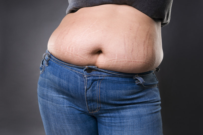 Poważna otyłość brzuszna może być szkodliwa nie tylko dla zdrowia, ale i życia /123RF/PICSEL