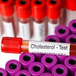 Powody, by zbadać poziom cholesterolu w organizmie. O jednym często zapominamy