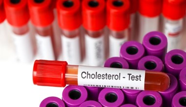 Powody, by zbadać poziom cholesterolu w organizmie. O jednym często zapominamy