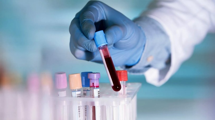 Powstał test krwi, który potrafi przewidzieć, czy umrzemy w ciągu najbliższych 5-10 lat /Geekweek