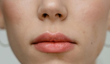 Pozbądź się "zmarszczek palacza" eliksirem z kuchni. Efekty mogą zaskoczyć każdego