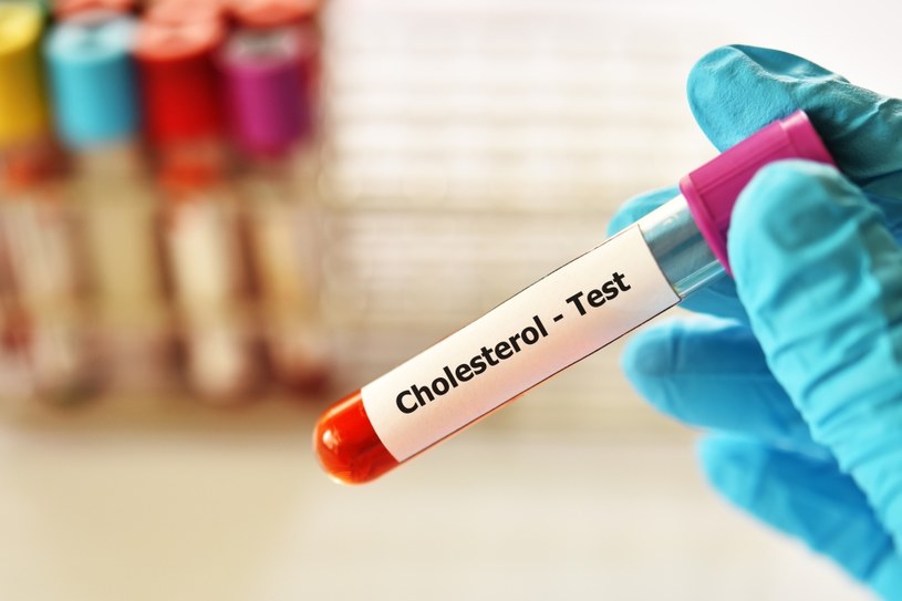 Poziom cholesterolu należy oznaczać minimum raz w roku /123RF/PICSEL