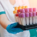 badania laboratoryjne Poziom krwinek w morfologii to wskaźnik stanu zdrowia. Co znaczą skróty RBC, HGB i WBC w badaniu krwi?