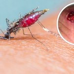 Poznaj komary-zombie. Odkryto gatunek przenoszący mięsożerne bakterie