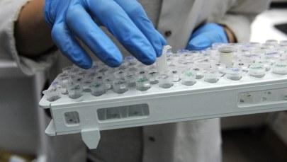 "Prawdopodobnie co trzecia osoba urodzona po 1960 r. zachoruje na nowotwór" 