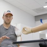 bioniczna ręka Prawdziwy interfejs człowiek-maszyna. Lekarze wszczepiają bioniczną rękę