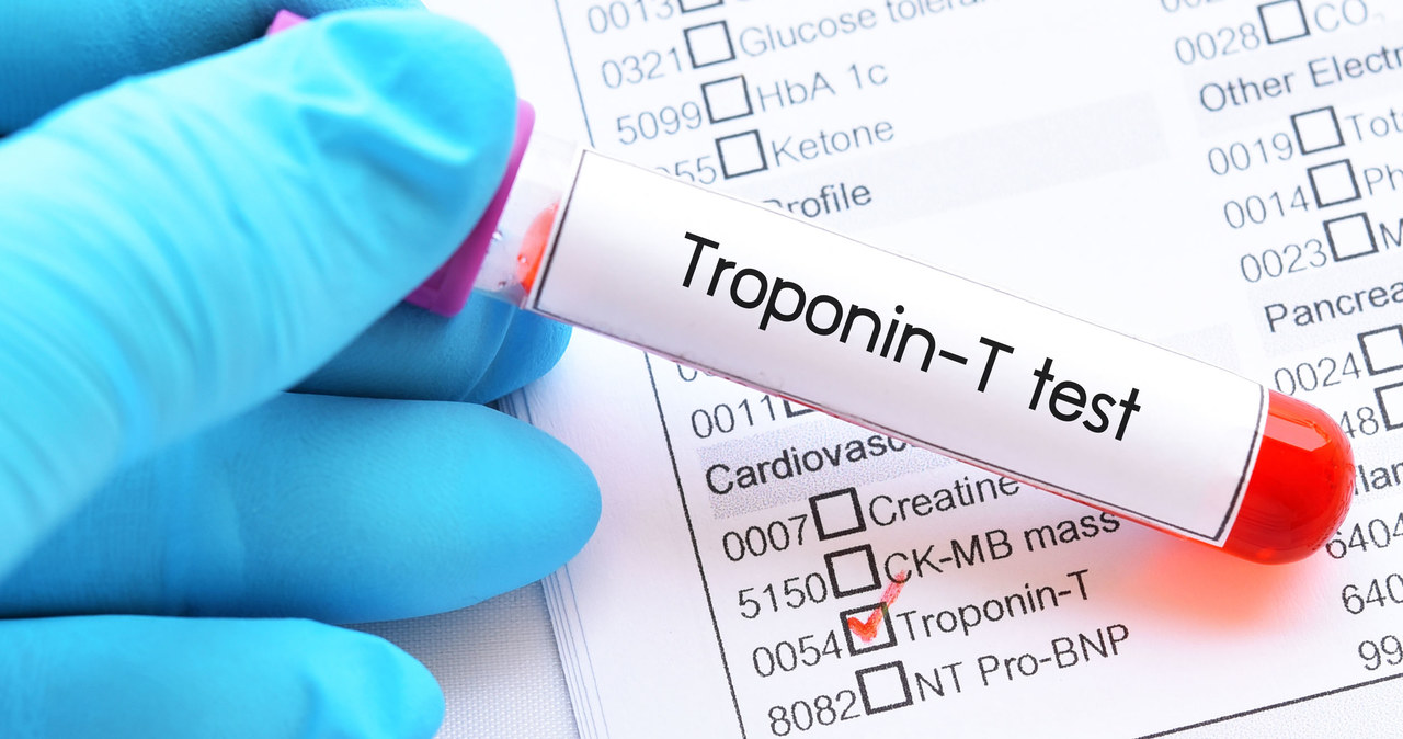 Prawidłowe stężenie troponin przyjmuje się za zerowe /123RF/PICSEL