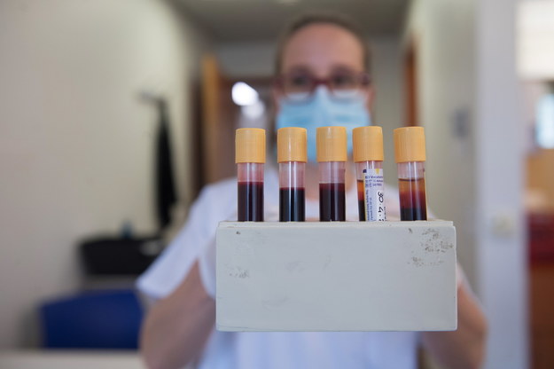 Próbki krwi pobrane do testów na koronawirusa /ALESSANDRO CRINARI /PAP