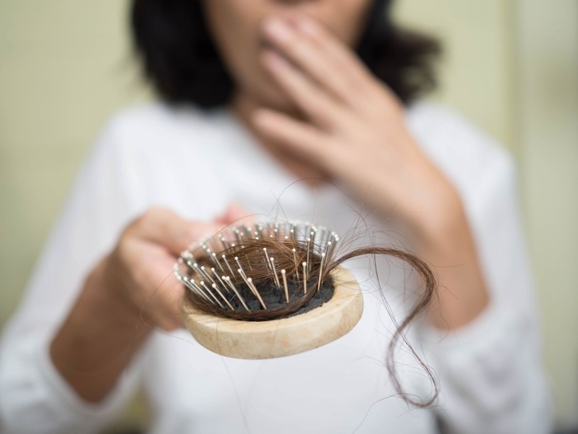 Problem łysienia dotyka coraz więcej kobiet po 30. roku życia /123RF/PICSEL