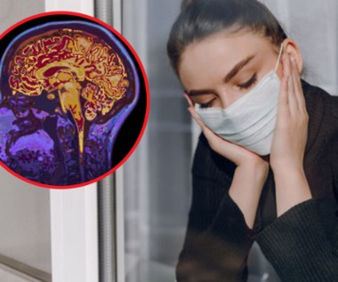 Problemy psychiczne mogą brać się... z powietrza. Tak smog uszkadza mózg