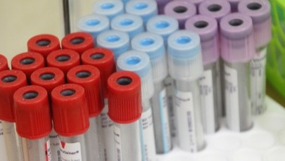 Problemy z dostępem do leku wydłużającego życie chorych na raka trzustki