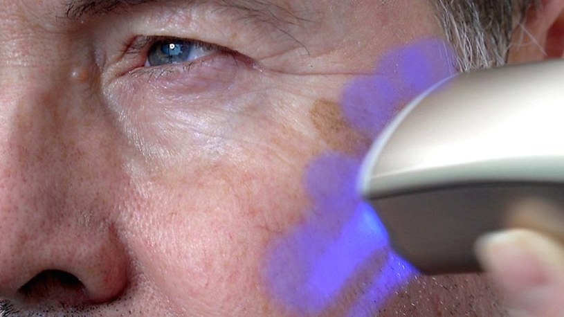 Procter & Gamble stworzył magiczne urządzenie, które szybko odmładza twarz /Geekweek