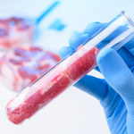 Produkcja mięsa komórkowego: Włosi chcą zakazać, Holendrzy je swobodnie degustują. Jaką opcję wybiorą Polacy?