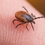 Prosty sposób na kleszcze. Sanepid podpowiada, co zrobić