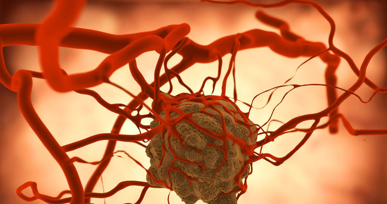 Prosty test krwi, który wykryje nowotwór długo zanim ten się pojawi? /123RF/PICSEL