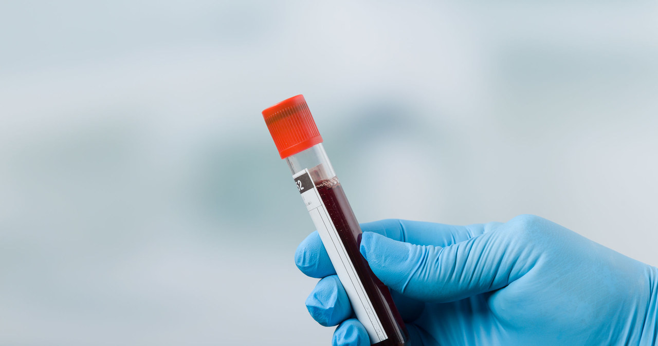 Prosty test krwi pozwoli na wykrycie raka? /123RF/PICSEL