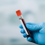 Prosty test krwi wykryje raka i jego stadium