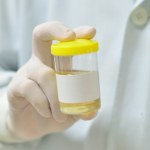 Prosty test moczu wykrywa ponad 9 na 10 przypadków raka pęcherza