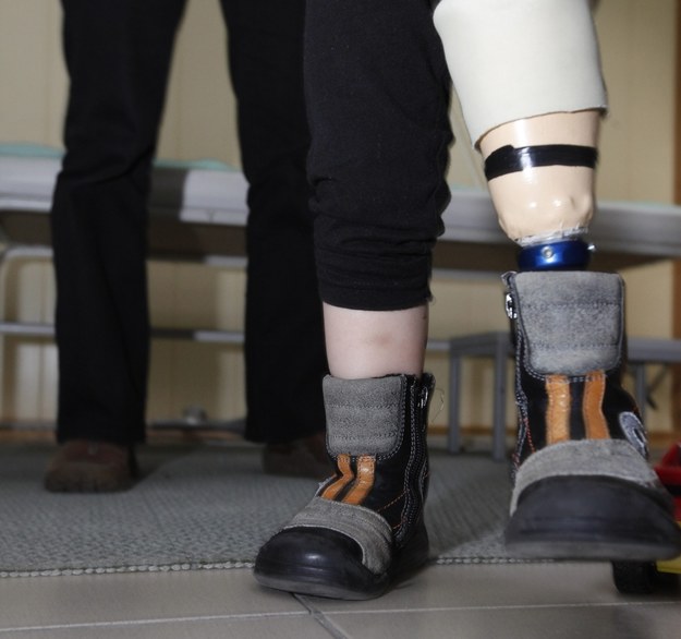 Mechaniczna proteza stawia na nogi