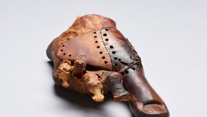 Protezę dużego palca miał... w małym palcu