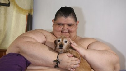 Przed operacją zrzucił 175 kg. Wciąż waży ponad 400!