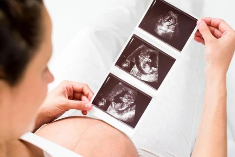Przed zajściem w ciążę warto upewnić się, czy organizm jest przygotowany do tak szczególnego stanu /123RF/PICSEL
