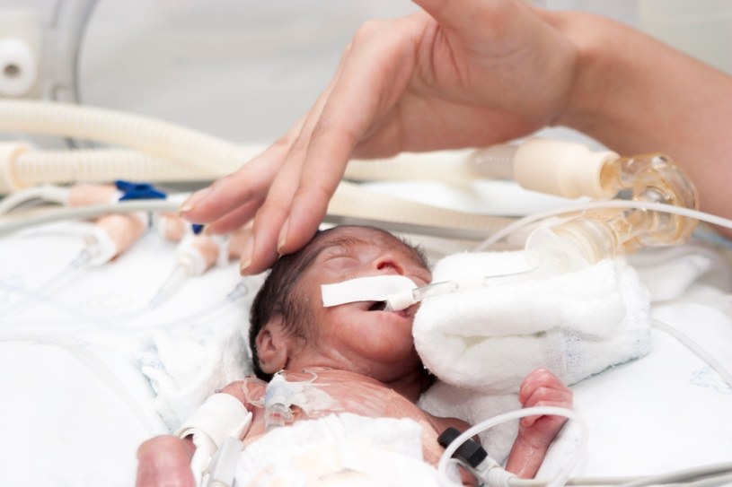Przedwczesne narodziny dziecka to jedno z najtrudniejszych doświadczeń dla rodziców /123RF/PICSEL