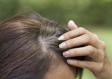 Przedwczesne siwienie – oto 5 nieoczywistych przyczyn