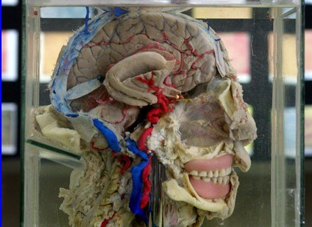 Przekrój ludzkiego mózgu przechowywany w Muzeum Mózgu w Limie /AFP