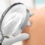 rak skóry Przełom w badaniach nad rakiem skóry. Odkryto kluczowy mechanizm ochrony