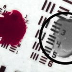 Przełom w chirurgii. Ta technologia pozwala "widzieć przez krew"
