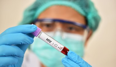 Przełom w leczeniu HIV. Wirus skończy zabawę w chowanego