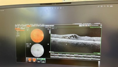 Przełom w telemedycynie na Lubelszczyźnie? Kontynuacja "Okobusa"