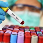 Przełom w walce z HIV. "Pacjent z Oslo" wyleczony po przeszczepie