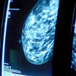 Przełom w walce z nowotworem piersi! Dwa znane leki hamują produkcję komórek rakowych