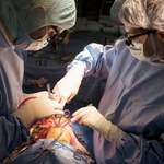 Przełomowa operacja! Kolejny pacjent z dwoma działającymi sercami