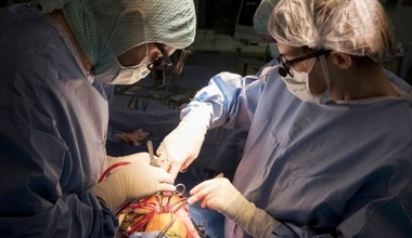 Przełomowa operacja! Kolejny pacjent z dwoma działającymi sercami