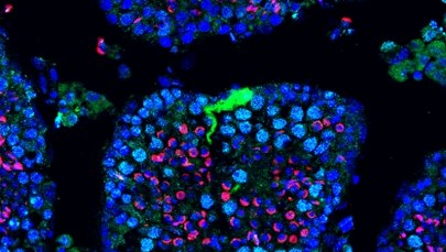 Przełomowa terapia mRNA przywraca płodność samcom myszy