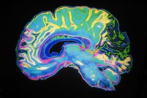 Przełomowe badania - sól wpływa na aktywność mózgu
