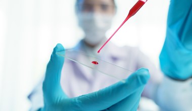 Przełomowe badanie krwi. Wykrywa raka 3 lata przed pojawieniem się objawów