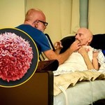Przełomowe odkrycie w walce z HIV. "Nigdy wcześniej nie byliśmy tak blisko"