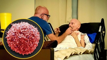 Przełomowe odkrycie w walce z HIV. "Nigdy wcześniej nie byliśmy tak blisko"