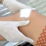 Przełomowy proszek na rany, który potrafi zatrzymać krwotok w sekundę