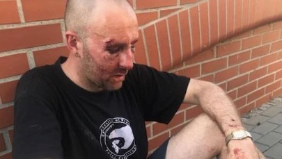 Przemysław Witkowski: Spotkałem się z przemocą w życiu, ale nie taką