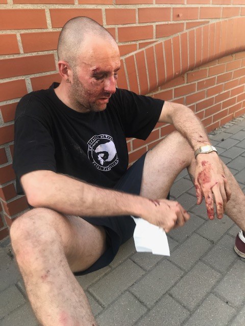 Przemysław Witkowski, wrocławski aktywista, poeta oraz nauczyciel akademicki został pobity na bulwarach odrzańskich za to, że nie podobał mu się napis "STOP PEDOFILOM Z LGBT" /Mateusz Czmiel /RMF FM