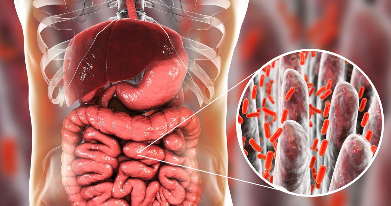Przerost flory bakteryjnej może wywoływać nadmierną produkcję gazów /123RF/PICSEL