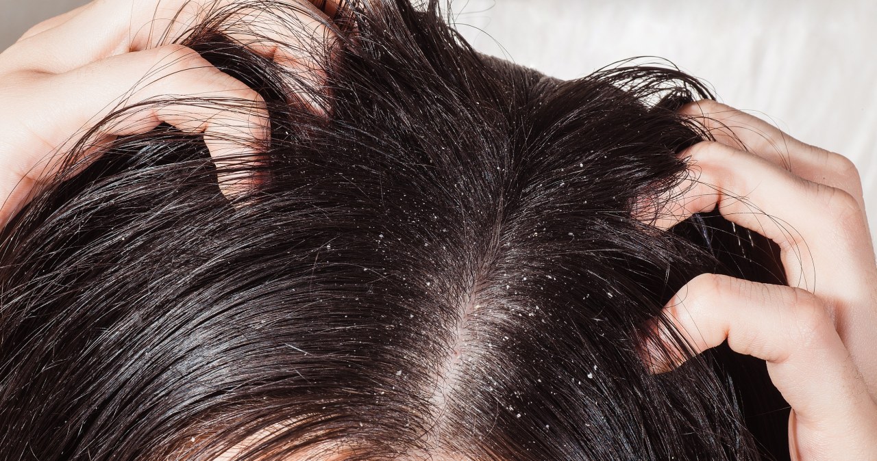 Przesuszoną skórę głowy ukoisz peelingiem cukrowym z olejem jojoba /Goncharov A. /123RF/PICSEL